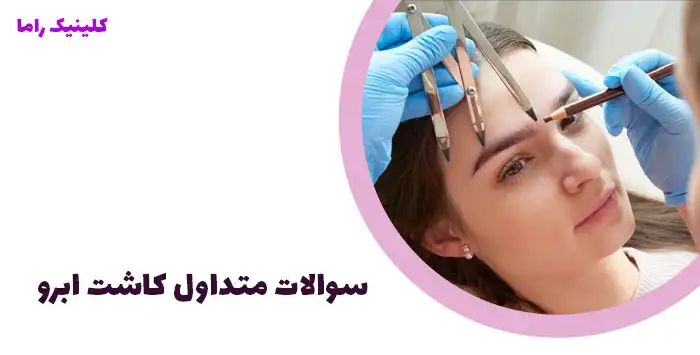 سوالات متداول کاشت ابرو 