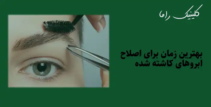 بهترین زمان برای قیچی ابروهای کاشته شده