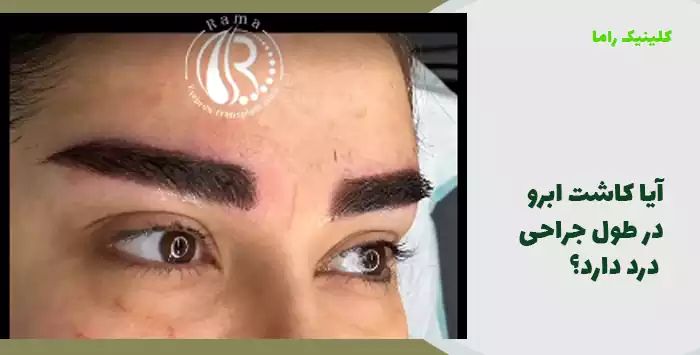 آیا کاشت ابرو در طول جراحی درد دارد؟