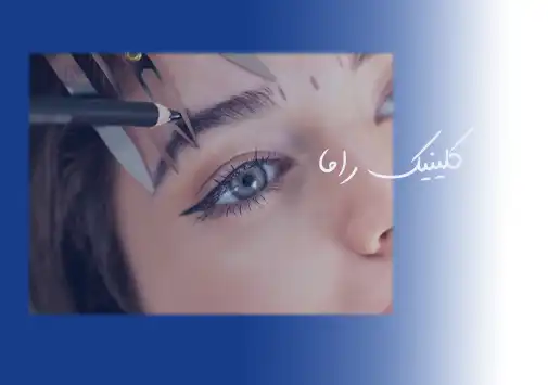 روش های اصلاح بعد کاشت ابرو