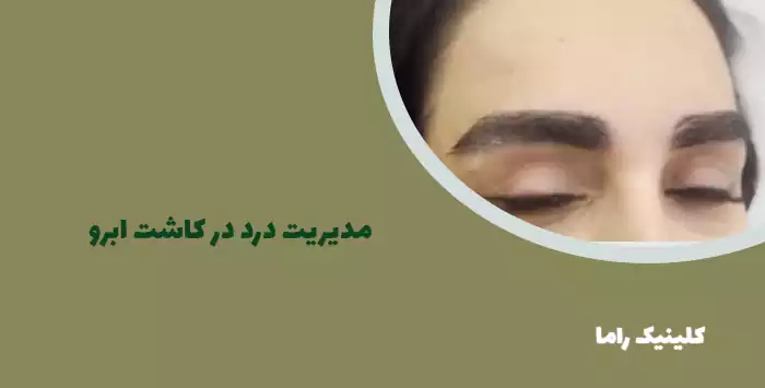 مدیریت درد در کاشت ابرو