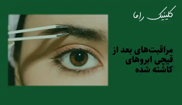 مراقبت‌های بعد از قیچی ابروهای کاشته شده