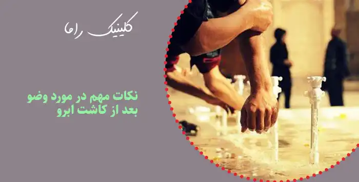 نکات مهم در مورد وضو بعد از کاشت ابرو