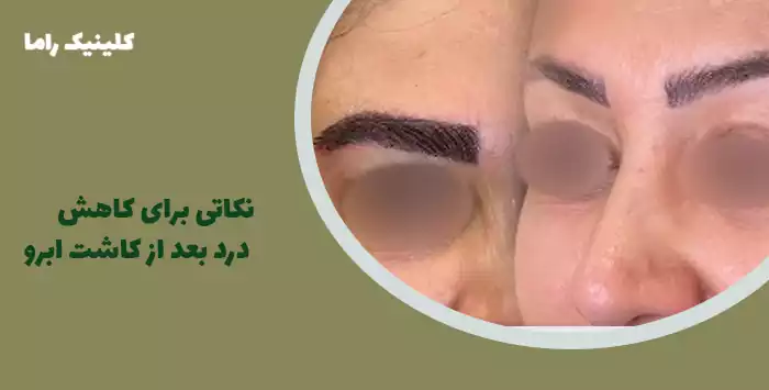 نکاتی برای کاهش درد بعد از کاشت ابرو