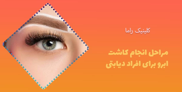 مراحل انجام کاشت ابرو برای افراد دیابتی