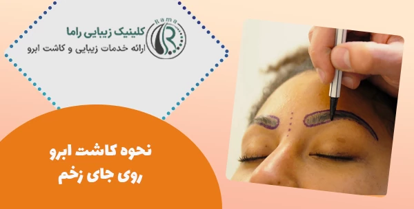 نحوه کاشت ابرو روی جای زخم 
