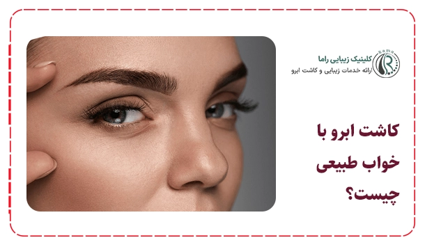 کاشت ابرو با خواب طبیعی چیست؟