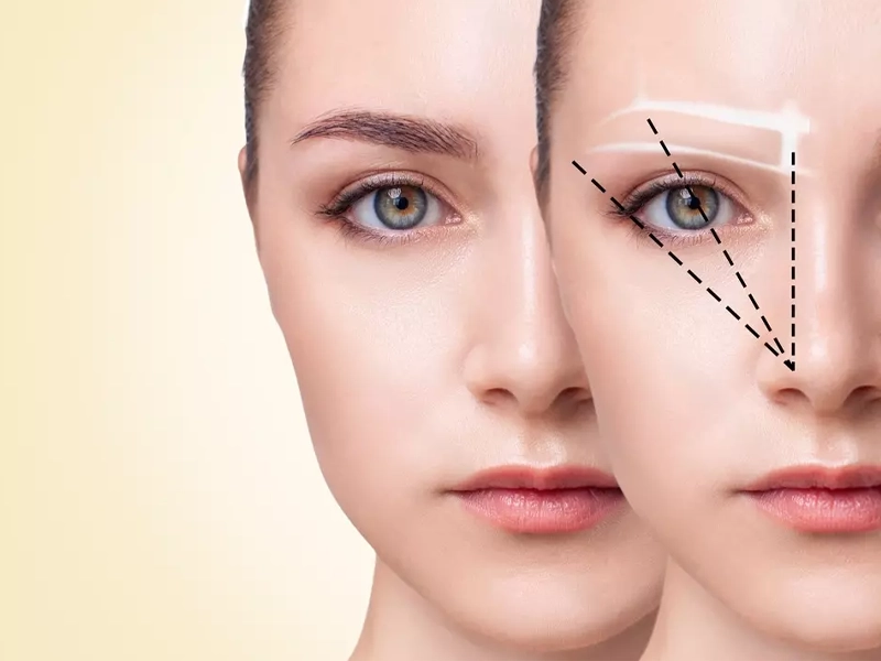 کاشت ابرو با خواب طبیعی