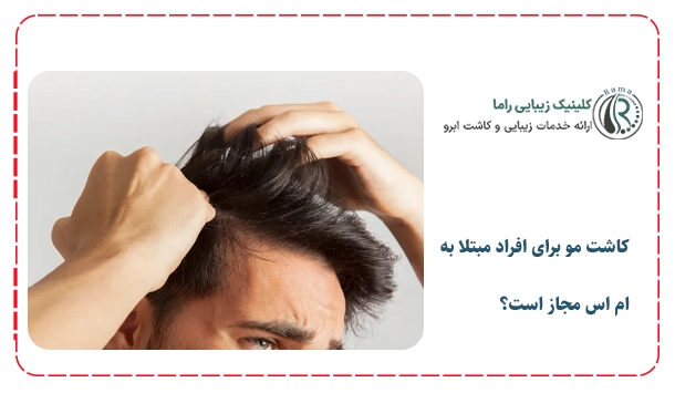 کاشت مو برای افراد مبتلا به ام اس مجاز است؟