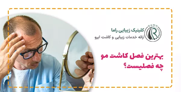 بهترین فصل کاشت مو چه فصلیست؟