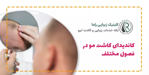 کاندیدای کاشت مو در فصول مختلف