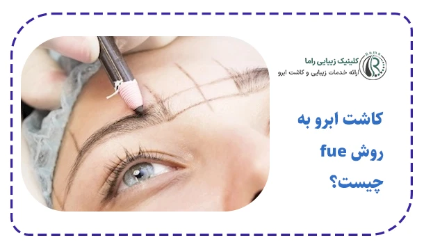 کاشت ابرو به روش fue چیست؟