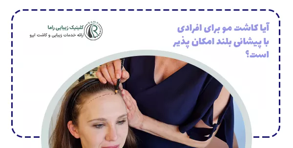 آیا کاشت مو برای افرادی با پیشانی بلند امکان پذیر است؟