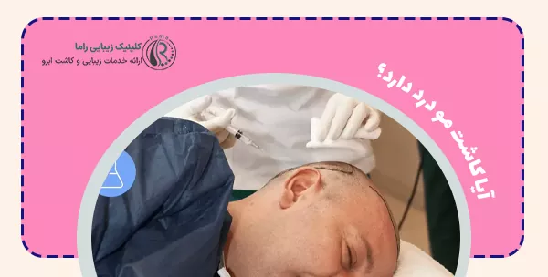 آیا کاشت مو درد دارد؟