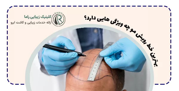 بهترین خط رویش مو چه ویژگی هایی دارد؟