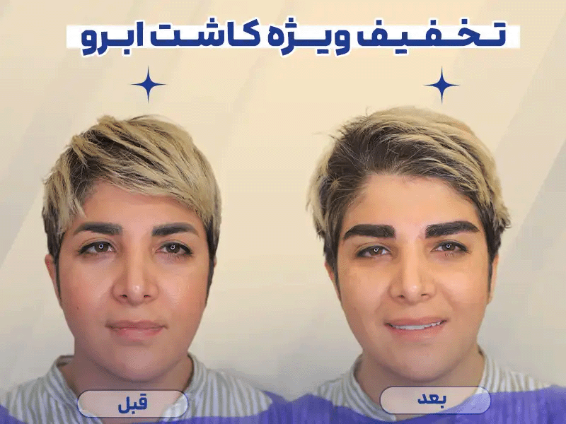 گیف تخفیف ویژه کلینیک راما
